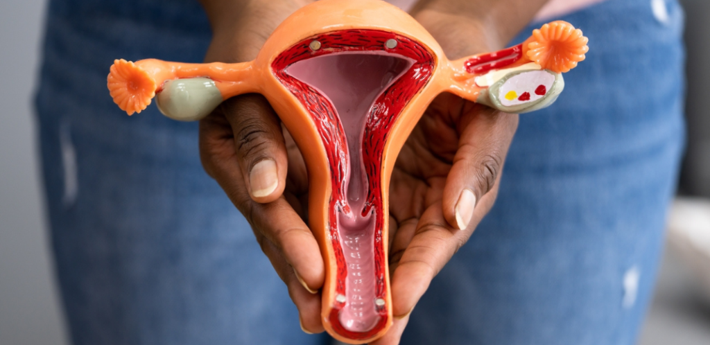Foto mostra mulher segurando a representação de um útero, alertando para a questão do câncer de colo de útero